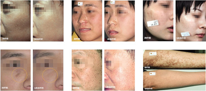 ���斑���容仪器