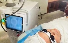 去痘印機器多少錢一臺？去痘印用什么機器_祛痘印痘坑的儀器是什么