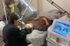 皮秒激光儀器哪個品牌的好？國產超皮秒品牌_皮秒設備哪個品牌最好